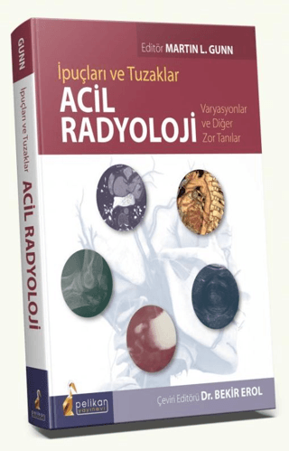 Acil Radyoloji