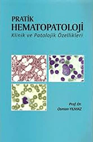 Pratik Hematopatoloji Klinik ve Patolojik Özellikleri